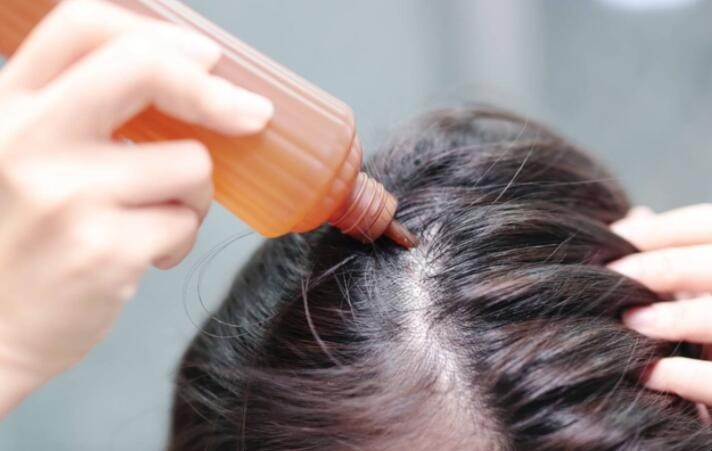 头发油怎么办小妙招不能洗头 头发油怎么办?去除头发油腻的秘诀